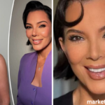 kris jenner face lift