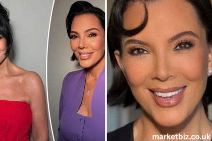 kris jenner face lift