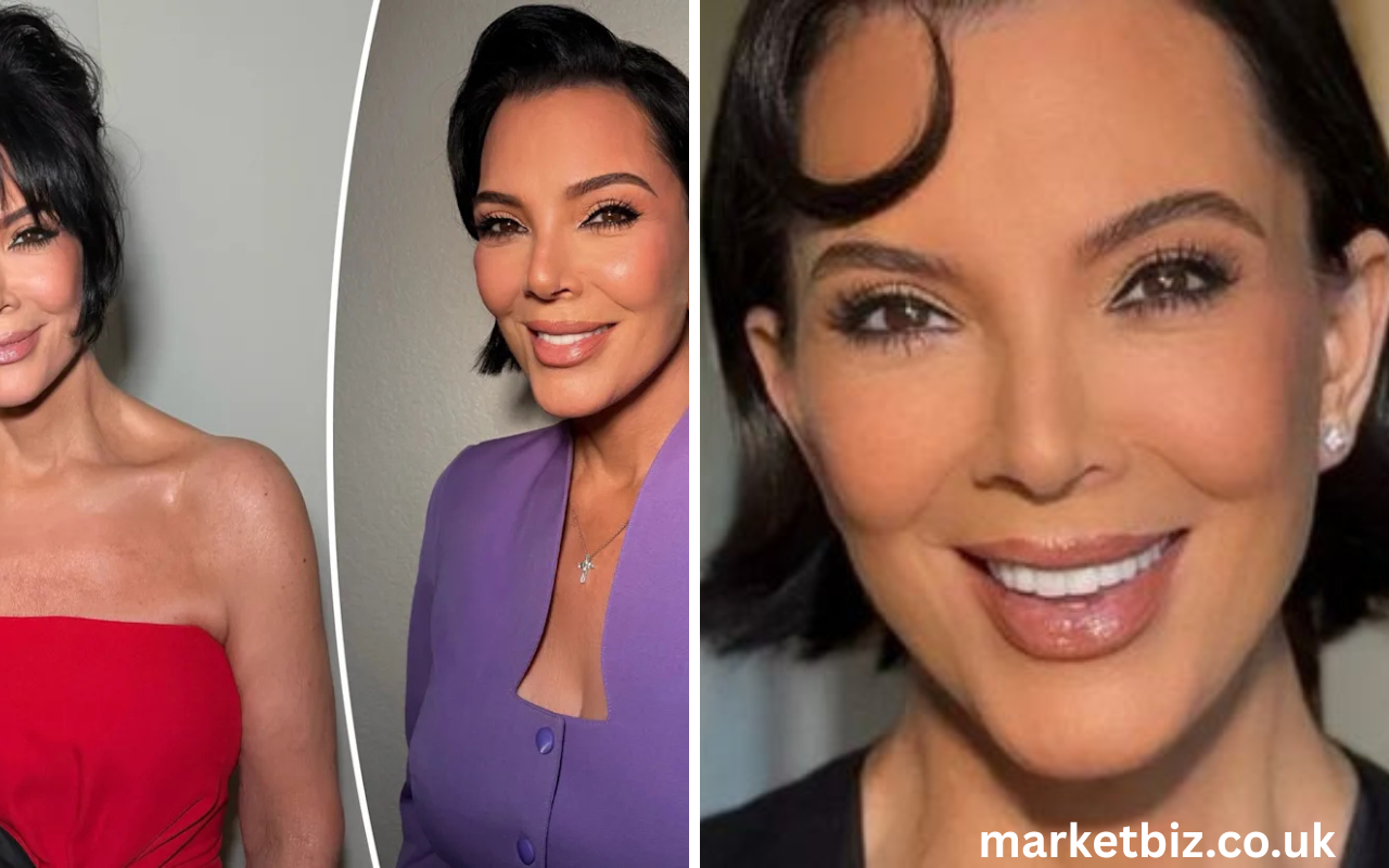kris jenner face lift