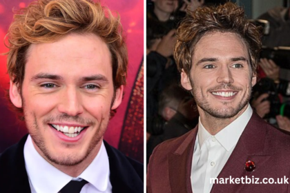 sam claflin veneers
